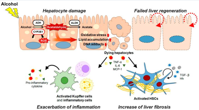 酒精及其代謝物通過各種途徑和/或機(jī)制共同促進(jìn)ALD的發(fā)病機(jī)制。（如圖1）