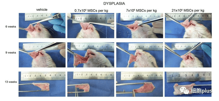 在腫瘤增生期，全身注射同種異體間充質干細胞不會加速癌前病變的進展。
