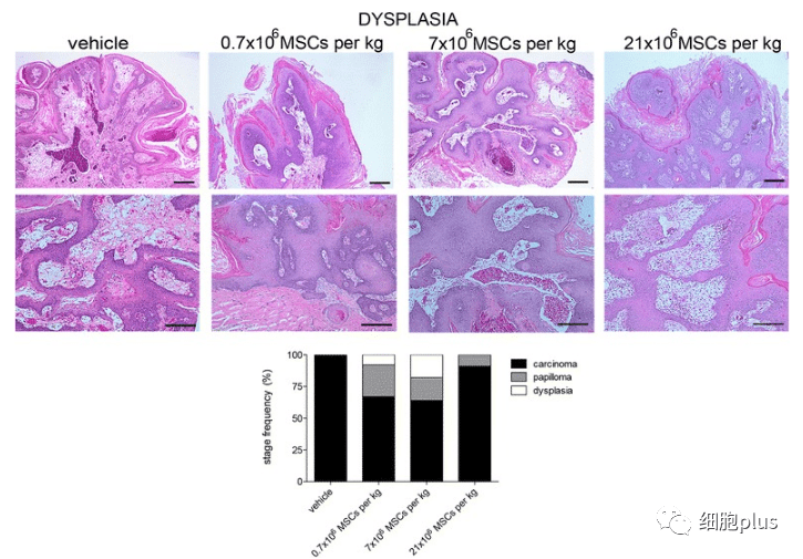 在增生期，全身注射同種異體間充質干細胞不會增加腫瘤的惡性程度。
