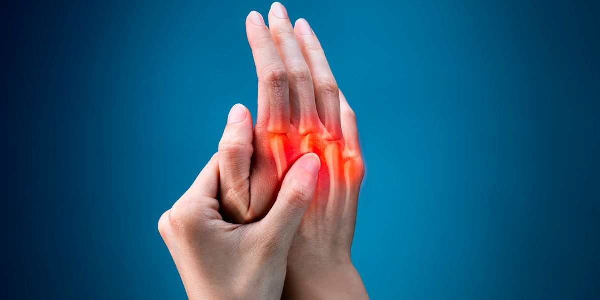 用于治療類風濕性關節炎的干細胞 用于治療類風濕性關節炎的干細胞