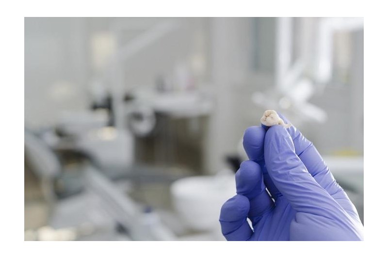 來自牙齒的干細胞可以幫助治療抑郁癥 來自牙齒的干細胞可以幫助治療抑郁癥