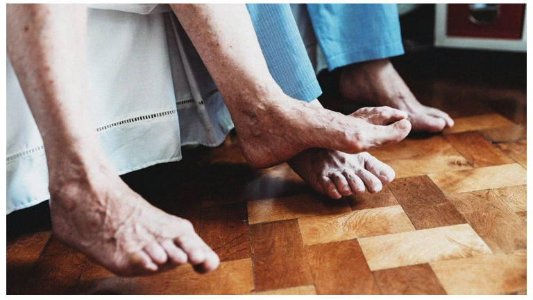 什么是類風濕關節炎？癥狀，治療，原因以及你需要知道的一切