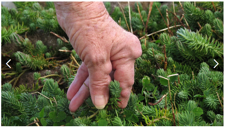 類風濕關節炎癥狀
