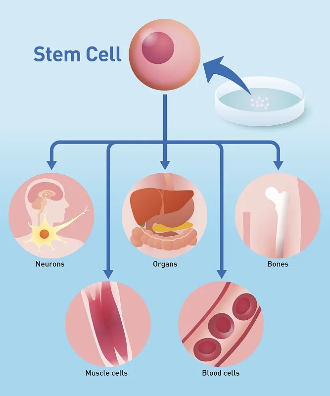 自體干細(xì)胞移植:工作原理、益處和風(fēng)險(xiǎn) 自體干細(xì)胞移植:工作原理、益處和風(fēng)險(xiǎn)