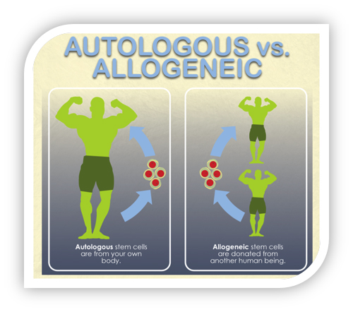 自體與同種異體干細胞