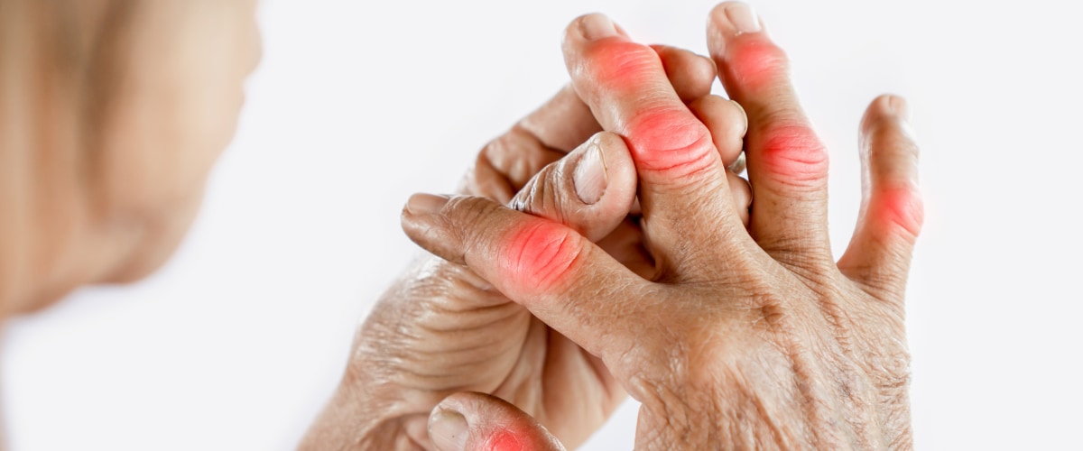 間充質干細胞治療全身性風濕病的臨床研究進展 間充質干細胞治療全身性風濕病的臨床研究進展