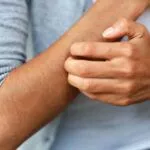 肝臟損傷的警告信號，肝臟疾病的警告信號 - 瘙癢