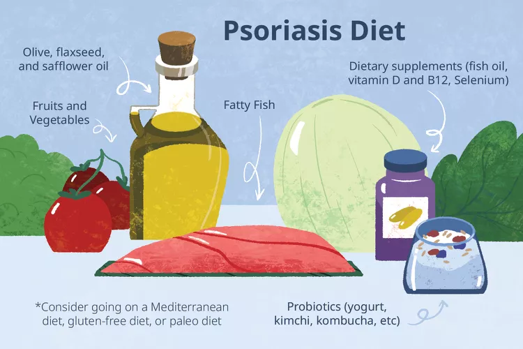 適合銀屑病患者吃的5種食物，你知道幾種？