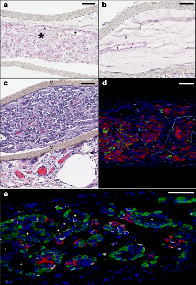 圖3：植入后第6個月時裝置封裝的人類干細胞衍生植入物的成分。