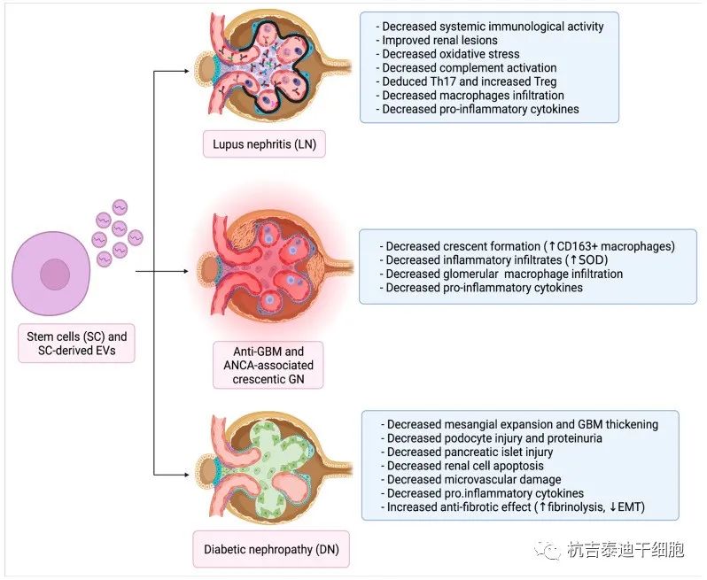 干細胞和EV作為原發性腎小球腎炎的治療工具