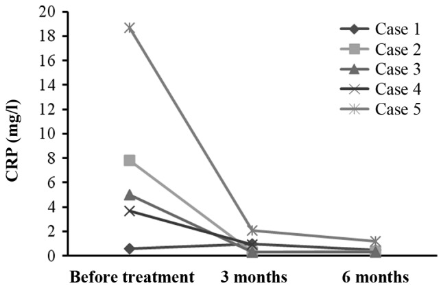 圖4：每位患者治療前后的CRP水平。1名患者的CRP水平降低，而其他4名患者的CRP水平保持穩(wěn)定并在正常范圍內(nèi)。