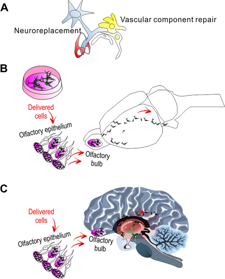 圖1：干細胞移植治療帕金森病的示意圖。