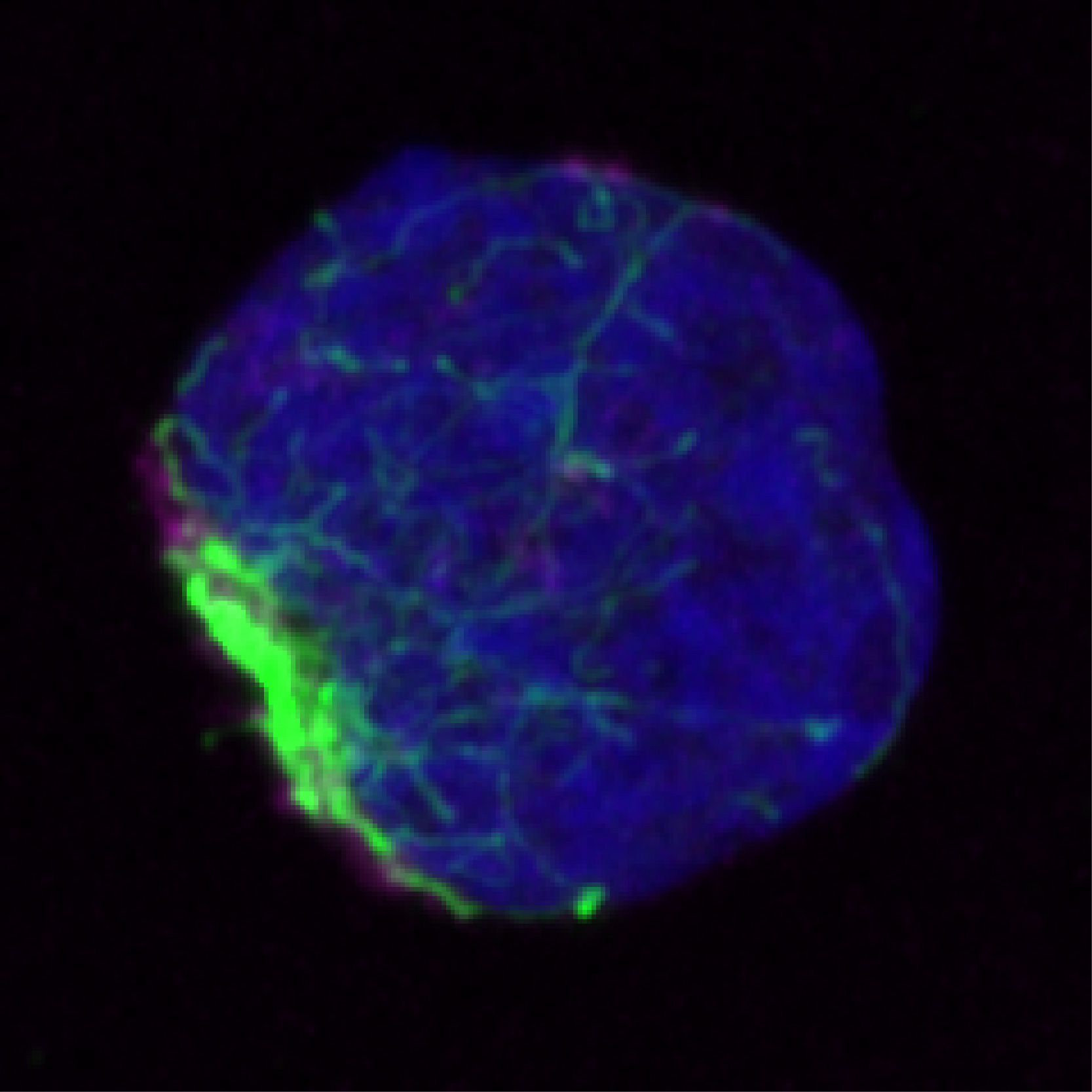 加州大學圣地亞哥分校的科學家發現，錯誤折疊的蛋白質在被處理之前聚集并被限制在干細胞內的單個區域（綠色）中。