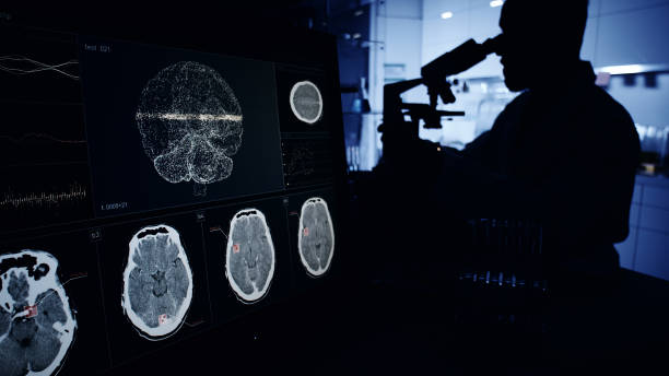 神經系統疾病發病機制復雜，涉及基因突變、衰老過程等多種因素。