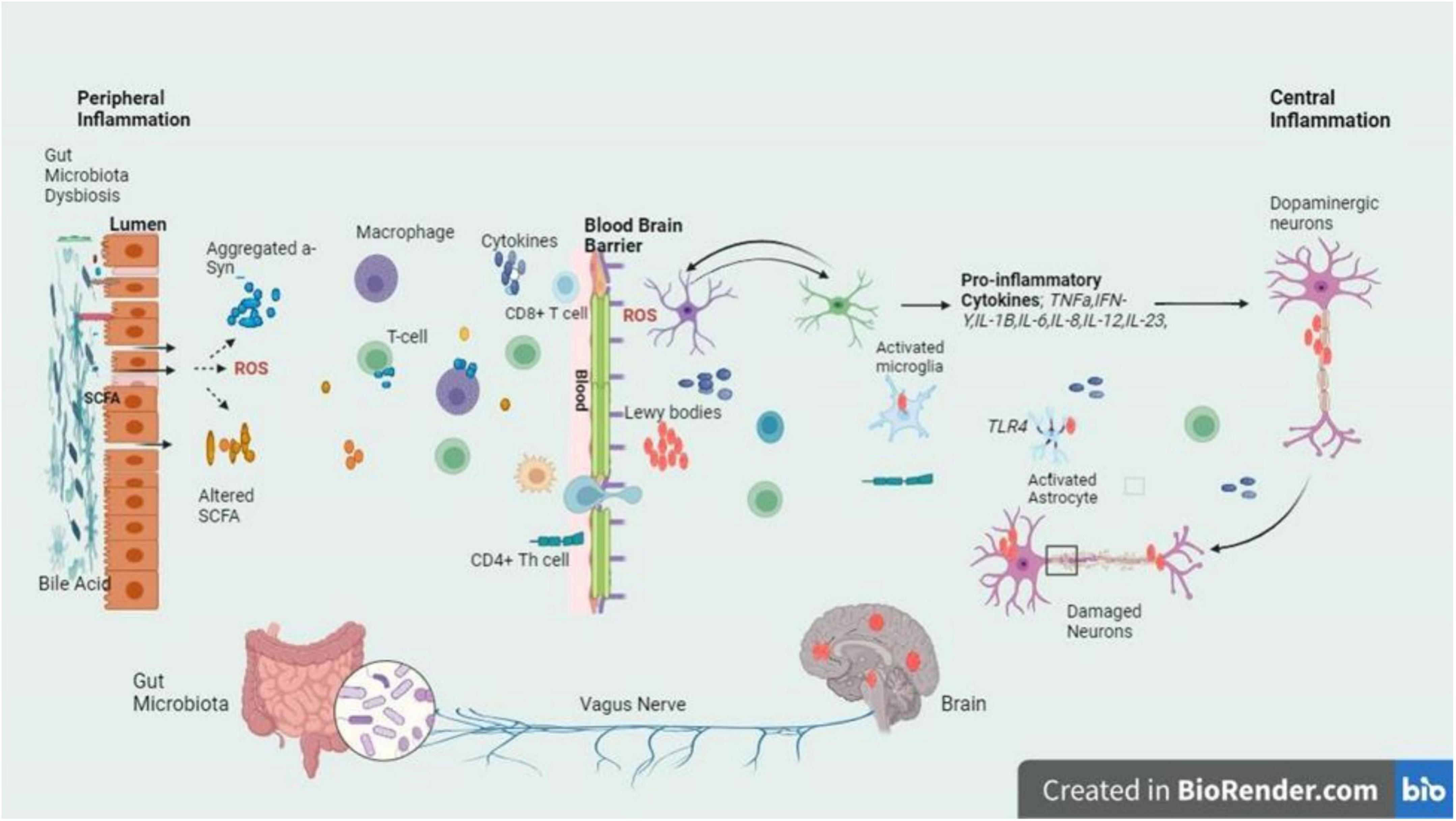 圖3：圖中的信號通路描繪了帕金森病腸道軸和大腦軸之間錯綜復(fù)雜的關(guān)系，重點是腸道內(nèi)腔和BBB的菌群失調(diào)引發(fā)的炎癥級聯(lián)反應(yīng)