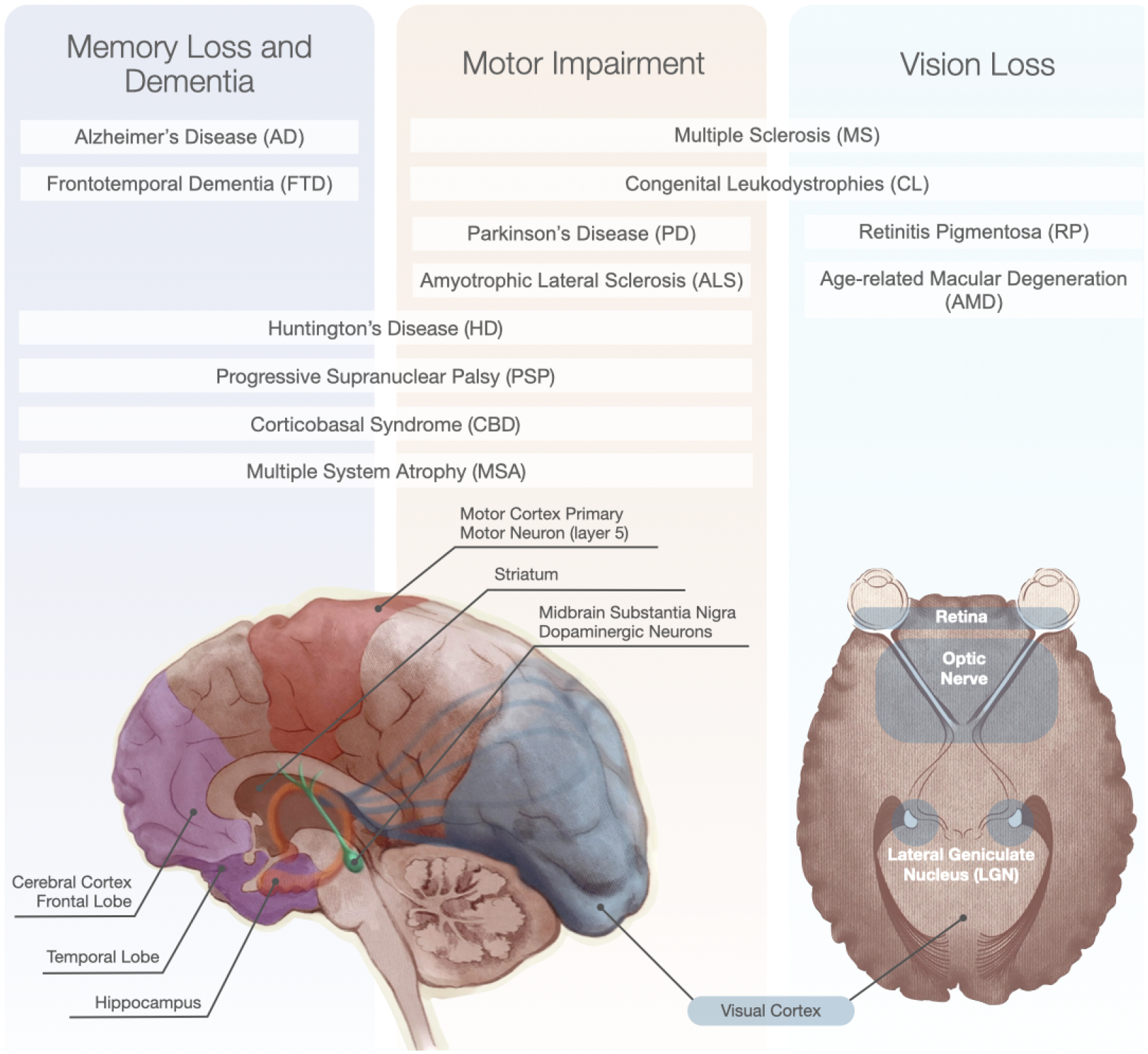 圖1：神經退行性疾病和受影響的大腦區域的主要功能影響。