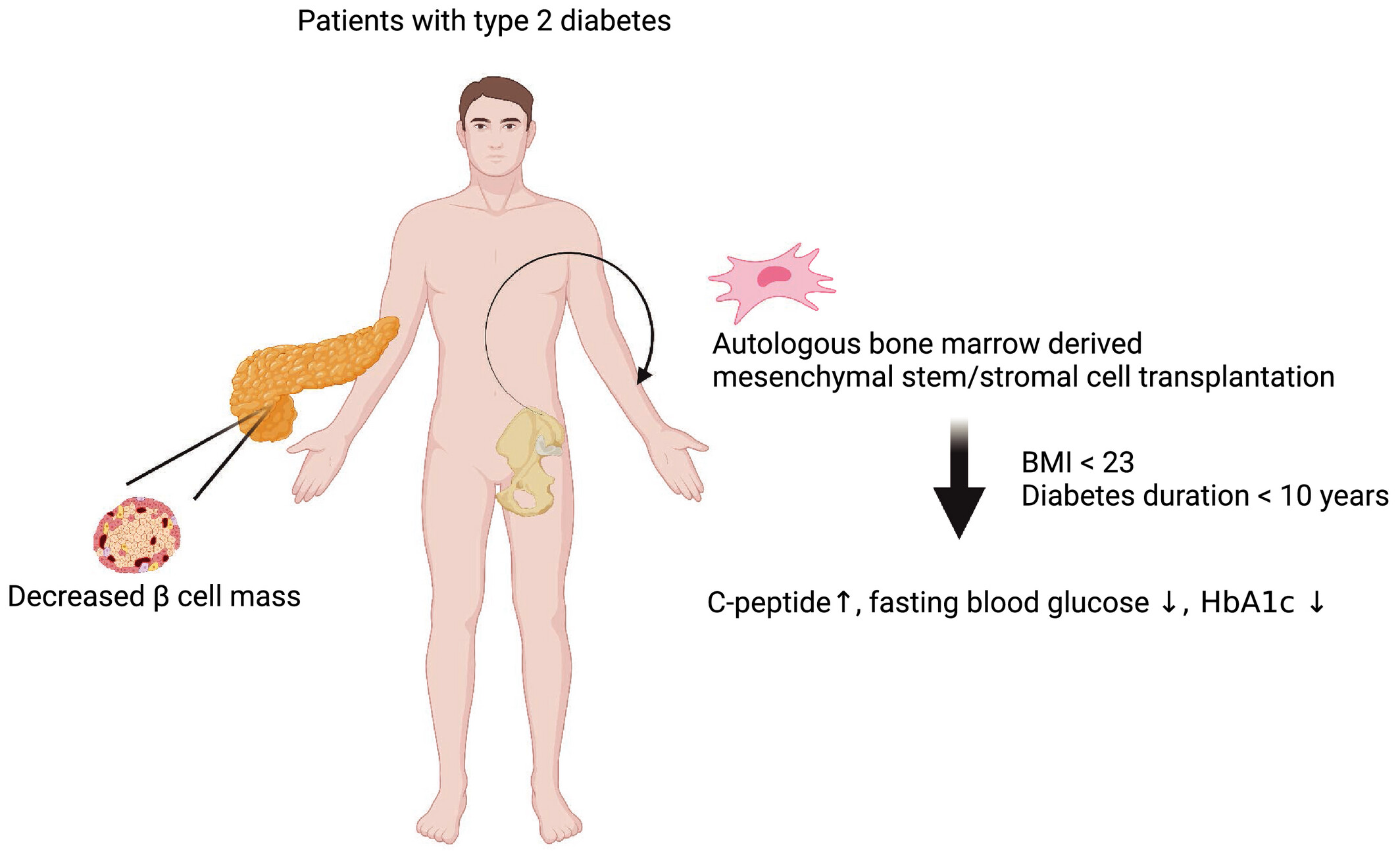 圖1：自體骨髓間充質/基質干細胞移植可以安全地改善2型糖尿病患者的高血糖癥并恢復C肽水平。