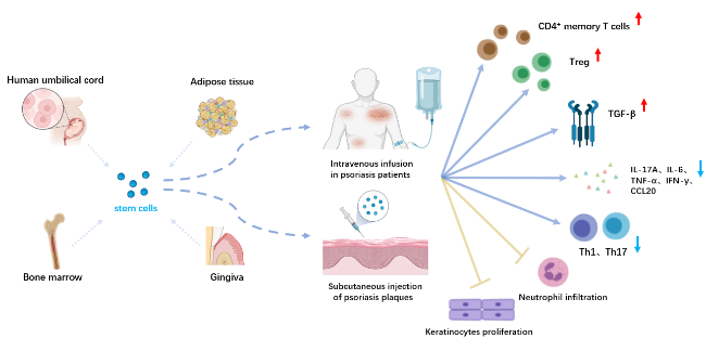 圖1：干細胞在牛皮癬治療中的應(yīng)用