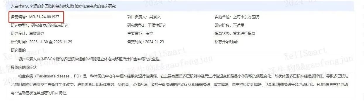 臨床級(jí)iPSC衍生多巴胺能神經(jīng)前體細(xì)胞治療帕金森病的臨床研究