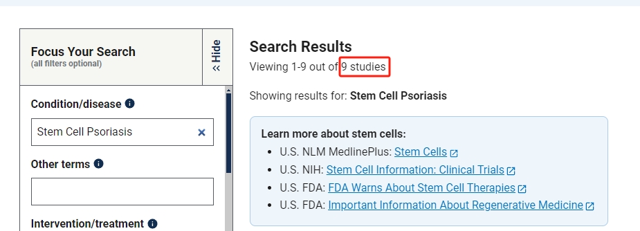 干細(xì)胞治療銀屑病臨床研究項目有9項。其中國內(nèi)發(fā)布的占據(jù)7項。 干細(xì)胞治療銀屑病臨床研究項目有9項。其中國內(nèi)發(fā)布的占據(jù)7項。