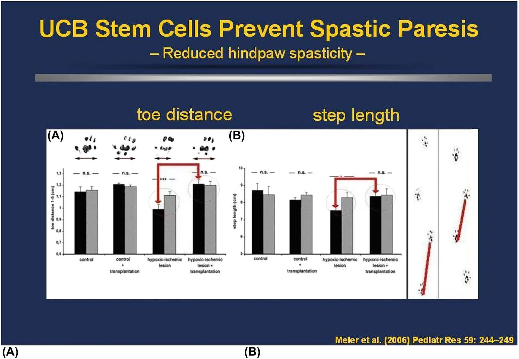 人類臍帶血MNC可預防PN7新生大鼠模型的痙攣性輕癱