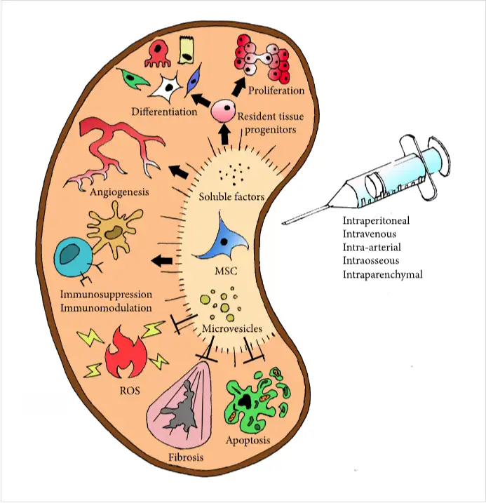 干細胞如何治療腎臟疾?。? class=