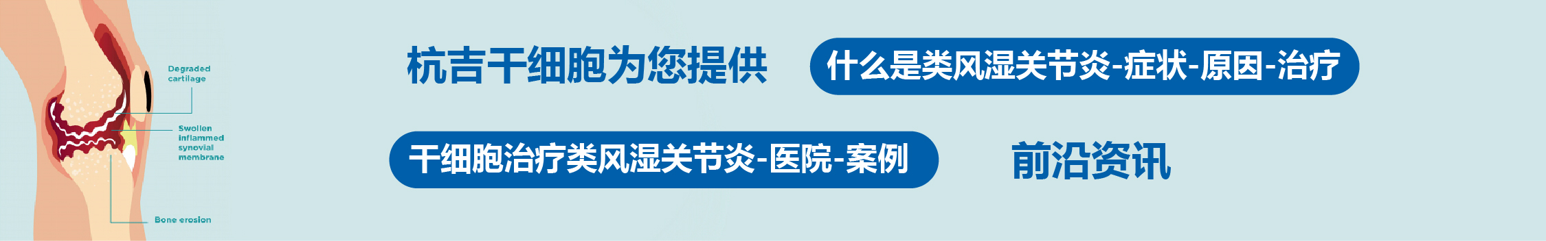 國(guó)內(nèi)外干細(xì)胞醫(yī)院治療類風(fēng)濕關(guān)節(jié)炎的臨床案例