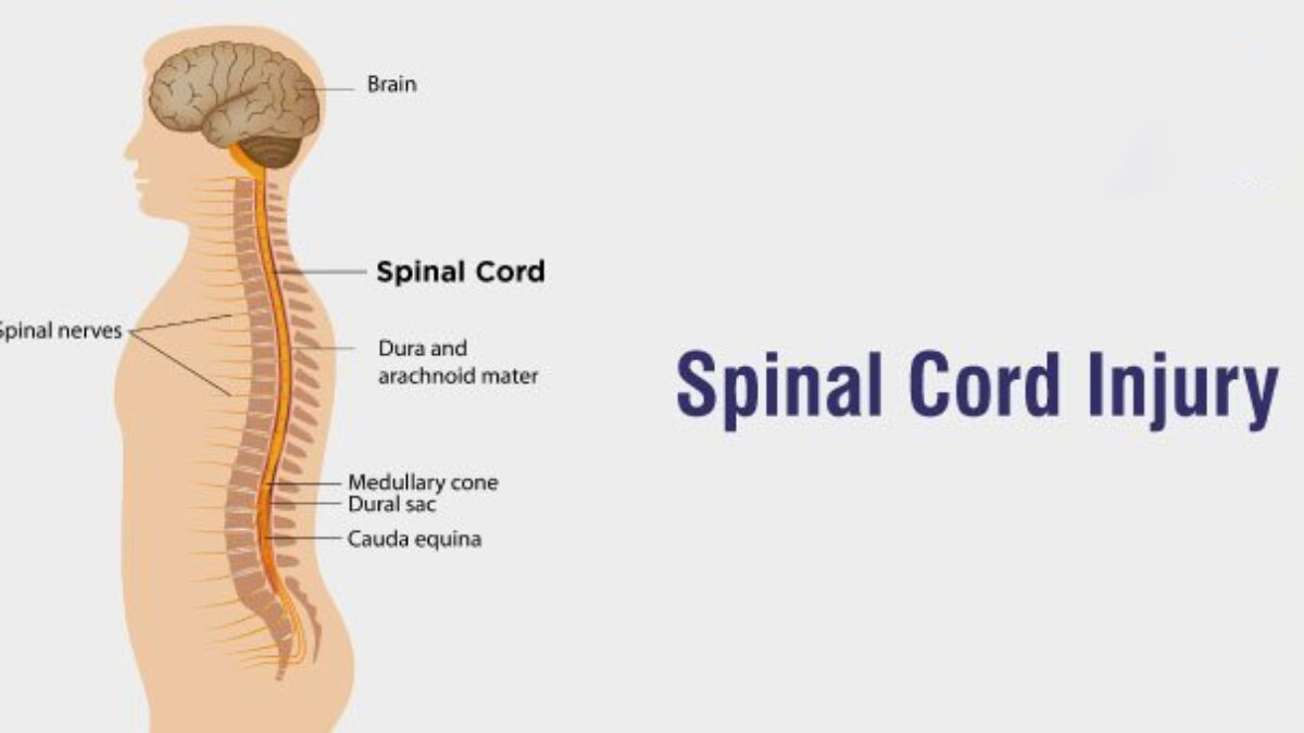 3項研究75例患者，評估干細胞治療脊髓損傷的安全性和有效性