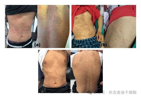 患者治療前后的對比圖 患者治療前后的對比圖