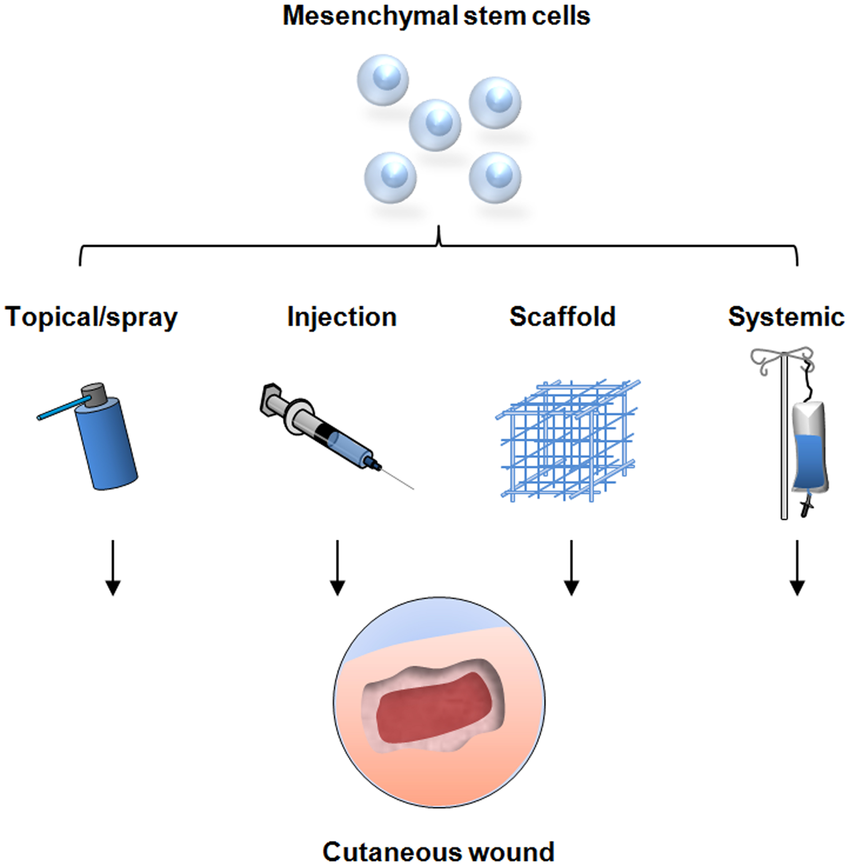 間充質(zhì)干細胞的治療方式有哪些—從傳統(tǒng)細胞移植到現(xiàn)代生物技術(shù)的應(yīng)用