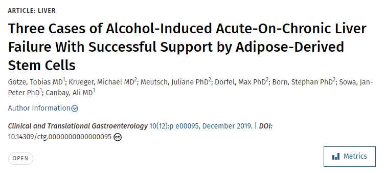 脂肪干細胞成功治療三例酒精性急性肝衰竭