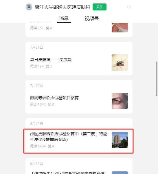干細胞臨床招募：邵逸夫醫院招募特應性皮炎濕診患者參與治療！