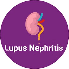 南京鼓樓醫院：干細胞治療92例狼瘡性腎炎，效果顯著！