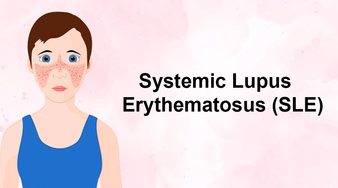 間充質(zhì)干細(xì)胞治療系統(tǒng)性紅斑狼瘡3大作用機(jī)制，你都了解嗎？