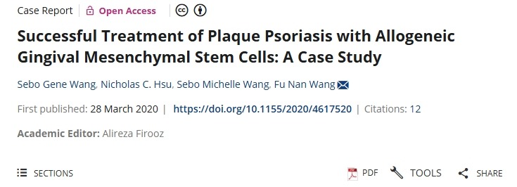 用同種異體牙齦間充質(zhì)干細胞成功治療斑塊狀銀屑病：案例研究