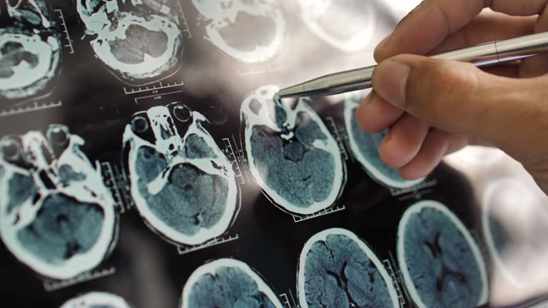 事關(guān)神經(jīng)退行性疾病，干細(xì)胞在治療神經(jīng)退行性疾病的療效、倫理、安全等問題的綜述