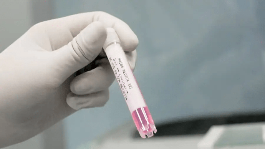 干細胞治療程序：??完整流程和所有步驟！