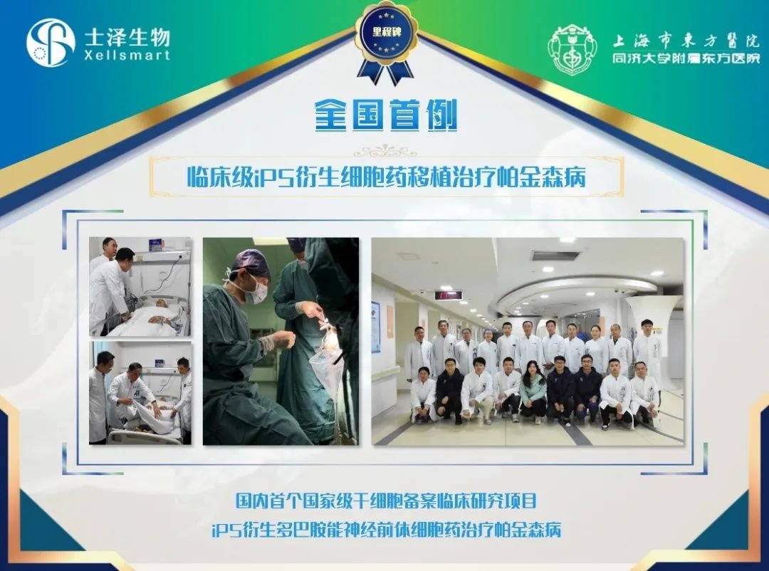 臨床級iPSC衍生多巴胺能神經前體細胞治療中重度帕金森病