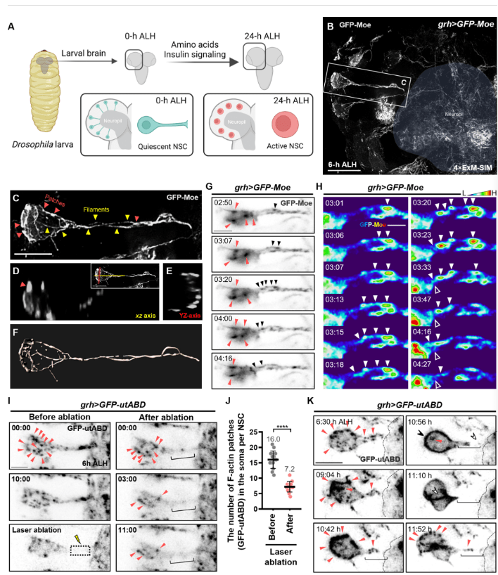 圖2：靜息態(tài)神經(jīng)干細(xì)胞再激活過程中的F-肌動蛋白結(jié)構(gòu)和動力學(xué)