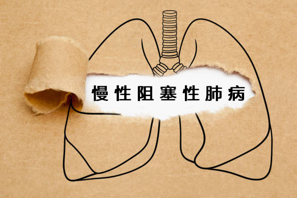 2024年干細胞治療慢阻肺的最新研究進展盤點