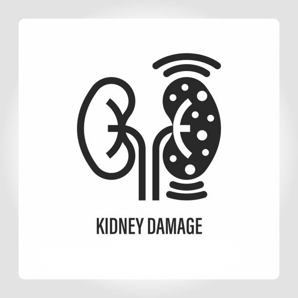 干細胞療法：扭轉腎病患者癥狀的關鍵力量