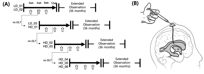 阿爾茨海默病患者 I 期方案研究流程圖
