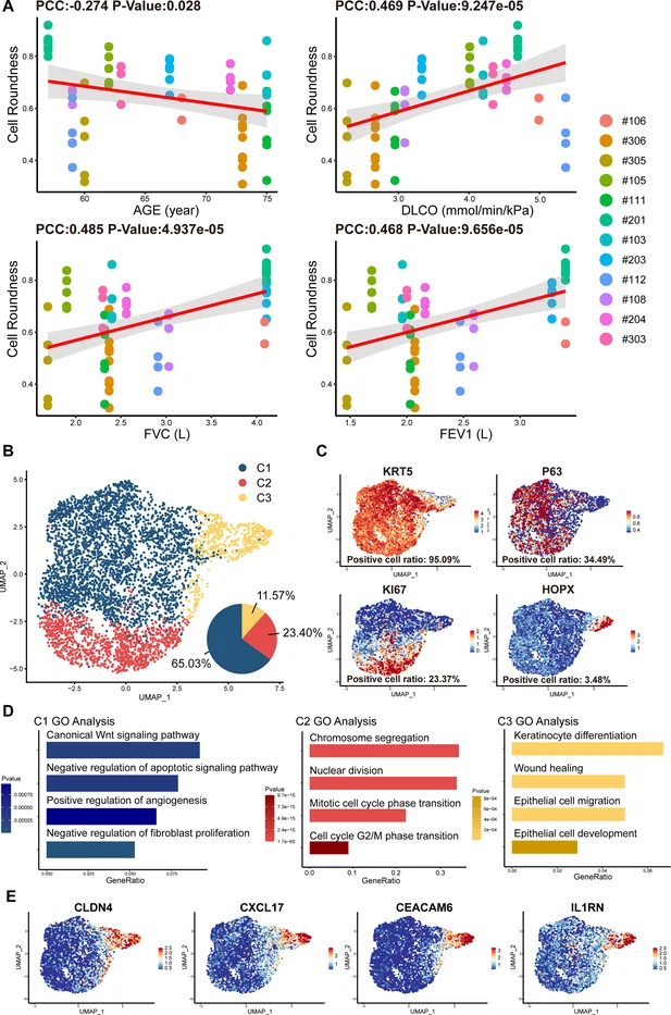 圖2：從IPF患者中分離的P63+肺祖細胞的細胞形態和單細胞RNA測序分析。