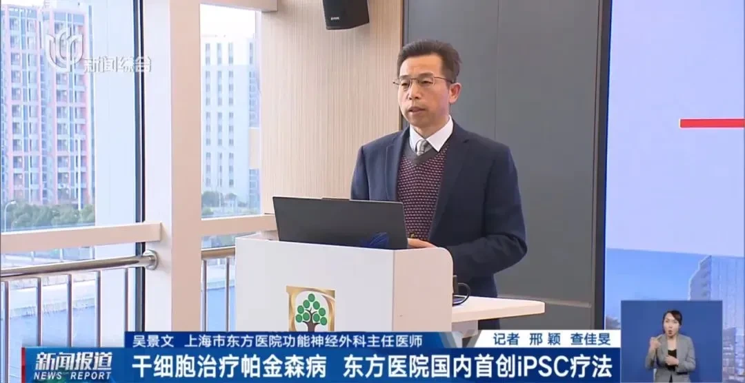 誘導多能干細胞衍生的多巴胺能神經前體細胞移植治療的帕金森病，12個月隨訪