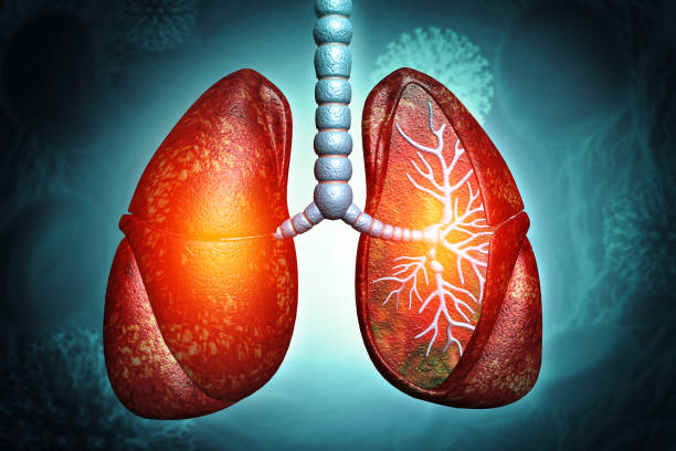 間充質(zhì)干細(xì)胞治療4大類肺部疾病的臨床試驗(yàn)進(jìn)展及挑戰(zhàn)