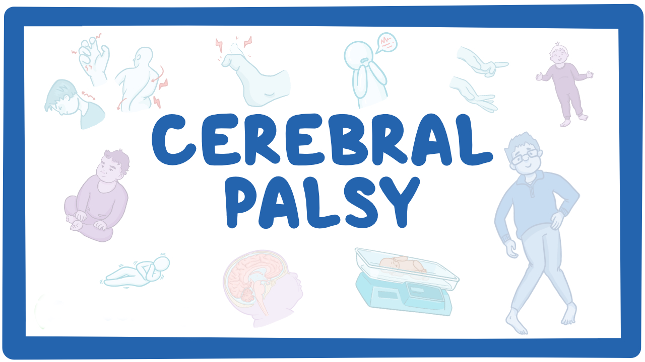 孩子腦癱有救了？神經干細胞移植治療腦癱的真實療效分享