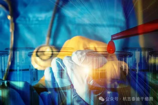 一名RA/MS患者經(jīng)過(guò)CAR-T治療失敗后，經(jīng)過(guò)自體干細(xì)胞移植后，主觀健康狀態(tài)顯著改善！