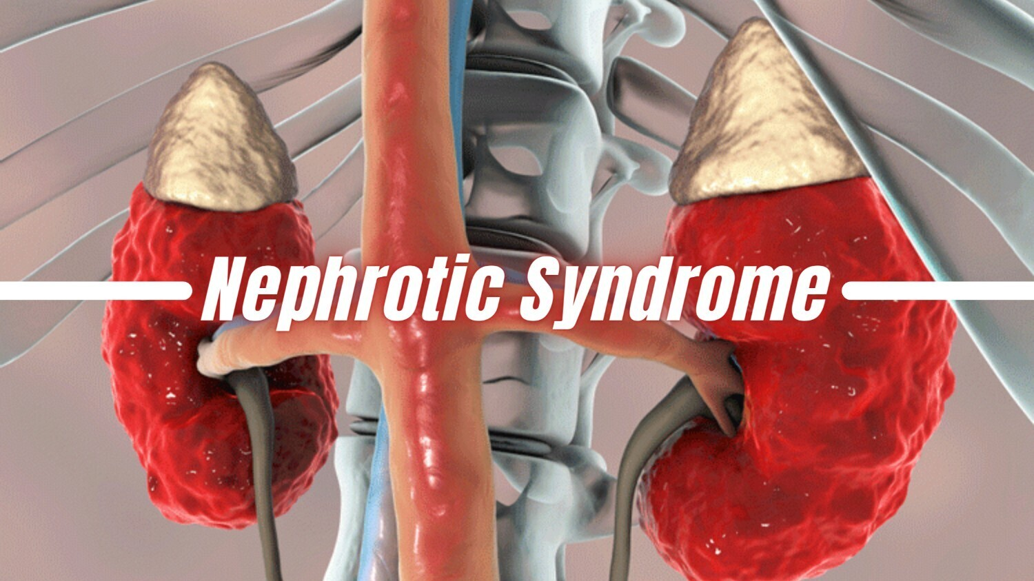2022-2025年干細(xì)胞治療腎病綜合征最新臨床研究進(jìn)展