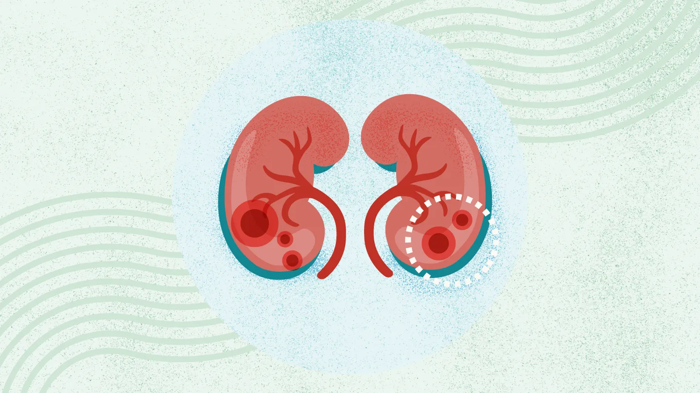 2025年國內干細胞治療腎病的醫(yī)院都有哪幾家？