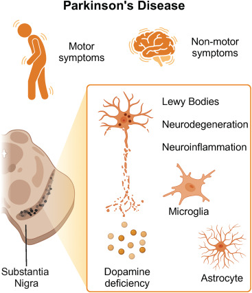 圖1：帕金森病的臨床和神經病理學特征